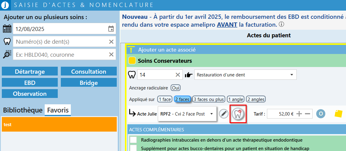 L'icône de la dent, à droite de l'acte, permet de choisir les faces d'une restauration. Si elle n'apparaît plus, le code graphique de l'acte doit être complété