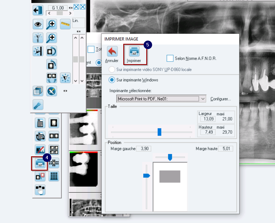 Cliquez sur Imprimer pour lancer l'impression