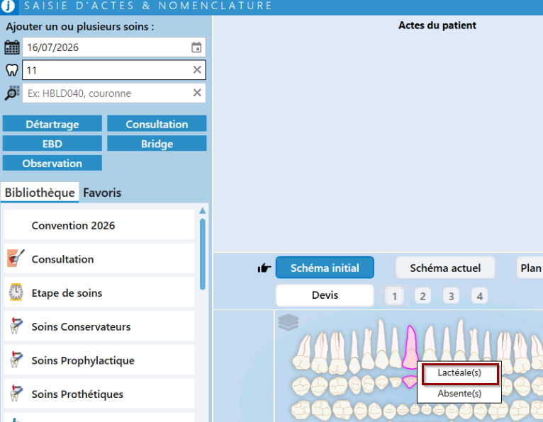 Faites un clic droit sur la dent, puis sélectionnez Lactéale