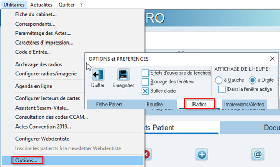 Ouvrez le menu Utilitaires > Options, onglet Radios