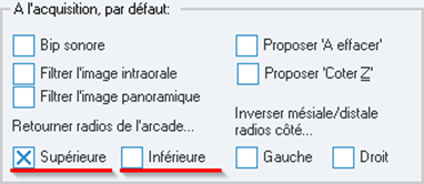 Dans Retourner radios de l'arcade..., faites des tests d'acquisition avec la case Supérieure ou Inférieure cochée